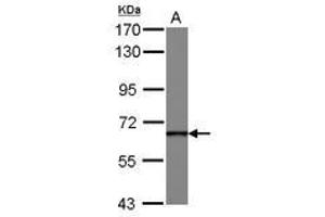 Image no. 1 for anti-DEAD (Asp-Glu-Ala-Asp) Box Polypeptide 49 (DDX49) (AA 66-318) antibody (ABIN1497806) (DDX49 抗体  (AA 66-318))