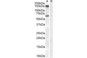 ABIN185506 (1µg/ml) staining of Human Brain lysate (35µg protein in RIPA buffer) with (B) and without (A) blocking with the immunising peptide. (Monoamine Oxidase B 抗体  (Internal Region))