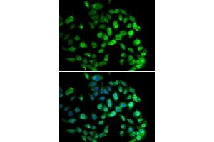 Immunofluorescence analysis of U20S cell using GPS1 antibody. (GPS1 抗体)
