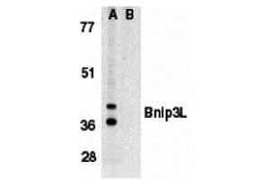 Western Blotting (WB) image for anti-BCL2/adenovirus E1B 19kDa Interacting Protein 3-Like (BNIP3L) antibody (ABIN1031701) (BNIP3L/NIX 抗体)