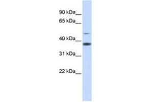 Image no. 1 for anti-Methylmalonic Aciduria (Cobalamin Deficiency) CblD Type, with Homocystinuria (MMADHC) (AA 216-265) antibody (ABIN6741309) (MMADHC 抗体  (AA 216-265))
