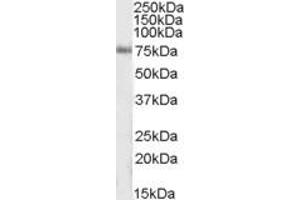 Image no. 1 for anti-Inositol-Trisphosphate 3-Kinase C (ITPKC) (AA 105-119) antibody (ABIN490480) (ITPKC 抗体  (AA 105-119))