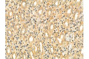 ABIN6261550 and ABIN6268786 at 1/100 staining Rat kidney tissue by IHC-P.