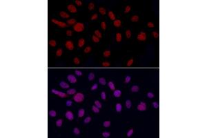 Immunofluorescence analysis of U2OS cells using YE Rabbit pAb (ABIN6130808, ABIN6150331, ABIN6150332 and ABIN6221925) at dilution of 1:50 (40x lens). (GAS41 抗体  (AA 1-227))