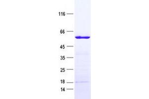 Western Blotting (WB) image for RRIO Kinase 3 (RIOK3) protein (His tag) (ABIN2730934)