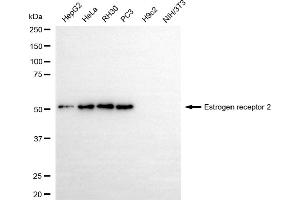 Western blotting analysis using estrogen receptor 2 antibody (ABIN7798494). (Recombinant ESR2 抗体)