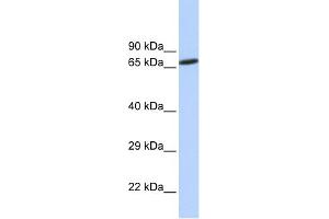 WB Suggested Anti-ZNF571 Antibody Titration:  0.