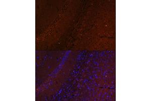Immunofluorescence analysis of mouse brain using RUSC1 antibody (ABIN7270114) at dilution of 1:100. (RUSC1 抗体  (AA 1-320))
