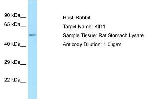 WB Suggested Anti-Klf11 Antibody   Titration: 1. (KLF11 抗体  (N-Term))
