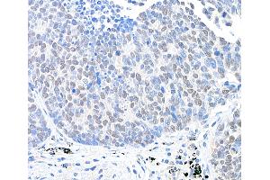 anti-Ubiquitin Specific Peptidase 28 (USP28) (AA 50-100) antibody