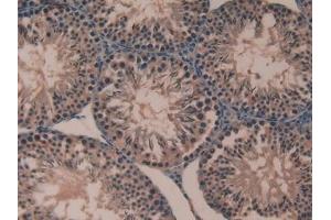 Immunohistochemistry (IHC) image for anti-Cyclophilin B (PPIB) (AA 34-216) antibody (ABIN7431392)