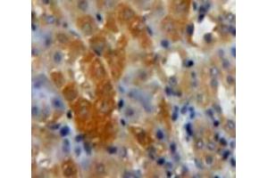 Used in DAB staining on fromalin fixed paraffin-embedded Kidney tissue (TGFB3 抗体  (AA 274-372))