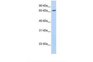 Image no. 1 for anti-Ring Finger Protein 139 (RNF139) (AA 72-121) antibody (ABIN6749727) (RNF139 抗体  (AA 72-121))