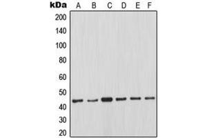 Western blot analysis of MCL1 expression in Ramos (A), JAR (B), K562 (C), Jurkat (D), Raji (E), HeLa (F) whole cell lysates. (MCL-1 抗体  (Center))