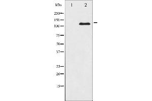 Western blot analysis of JAK2 expression in K562 whole cell lysates,The lane on the left is treated with the antigen-specific peptide. (JAK2 抗体  (N-Term))