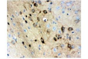 IHC analysis of Stathmin 1 using anti-Stathmin 1 antibody (ABIN3043301). (Stathmin 1 抗体  (N-Term))