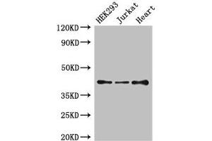 Western Blot Positive WB detected in: HEK293 whole cell lysate, Jurkat whole cell lysate, Mouse heart tissue All lanes: S1PR5 antibody at 4 μg/mL Secondary Goat polyclonal to rabbit IgG at 1/50000 dilution Predicted band size: 42, 33 kDa Observed band size: 42 kDa (S1PR5 抗体  (AA 309-398))