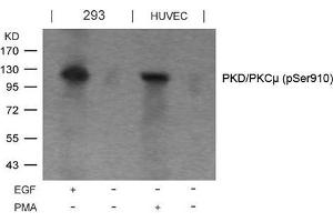 Western blot analysis of extracts from EGF-treated 293 and PMA-treated HUVEC cells using PKD/PKCm(Phospho-Ser910) Antibody. (PKC mu 抗体  (pSer910))