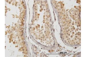 Immunostaining (ISt) image for anti-ATPase, H+ Transporting, Lysosomal 34kDa, V1 Subunit D (ATP6V1D) (AA 69-168) antibody (ABIN526691)