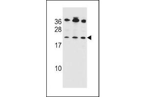 Bak antibody western blot analysis in 1) Jurkat, 2) MDA-MB453 and 3) 293 lysate (BAK1 抗体  (AA 56-91))