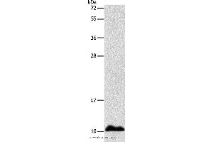 Western blot analysis of Human fetal liver tissue, using APOC1 Polyclonal Antibody at dilution of 1:500 (APOC1 抗体)