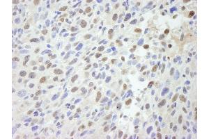 Immunohistochemistry (IHC) image for anti-Mediator Complex Subunit 12 (MED12) (C-Term) antibody (ABIN7448660) (MED12 抗体  (C-Term))