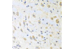 Immunohistochemistry of paraffin-embedded mouse brain using MLN antibody (ABIN5973790) at dilution of 1/100 (40x lens). (Motilin 抗体)