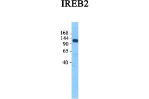Host:  Rabbit  Target Name:  IREB2  Sample Tissue:  Human Fetal Lung  Antibody Dilution:  1. (IREB2 抗体  (Middle Region))