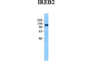 Host:  Rabbit  Target Name:  IREB2  Sample Tissue:  Human Fetal Lung  Antibody Dilution:  1.