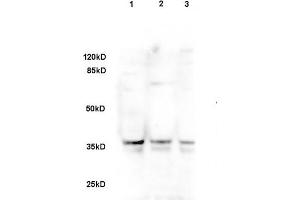 Sheep fat cell lysate 30ug, probed with Rabbit Anti-DLK1/DLL1 Polyclonal Antibody (ABIN740055) at 1:200 overnight in 4 °C. (DLK1 抗体  (AA 251-350))