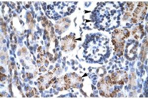 Human kidney; Rabbit Anti-GFI1B Antibody. (GFI1B 抗体  (N-Term))