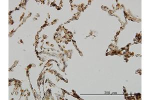 Immunoperoxidase of monoclonal antibody to UBE3A on formalin-fixed paraffin-embedded human lung. (ube3a 抗体  (AA 51-150))