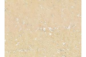 ABIN6259339 and ABIN6275439 at 1/100 staining human normal gastric tissue by IHC-P. (RSAD1 抗体  (Internal Region))