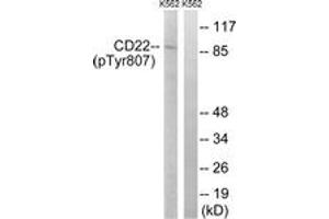 Western blot analysis of extracts from K562 cells treated with Na3VO4 0. (CD22 抗体  (pTyr807))