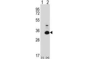 Western Blotting (WB) image for anti-TP53 Regulating Kinase (TP53RK) antibody (ABIN2997879) (TP53RK 抗体)