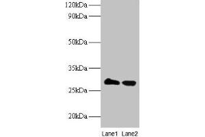 Western blot All lanes: TPMT antibody at 2 μg/mL Lane 1: EC109 whole cell lysate Lane 2: 293T whole cell lysate Secondary Goat polyclonal to rabbit IgG at 1/15000 dilution Predicted band size: 29 kDa Observed band size: 29 kDa (TPMT 抗体  (AA 4-244))