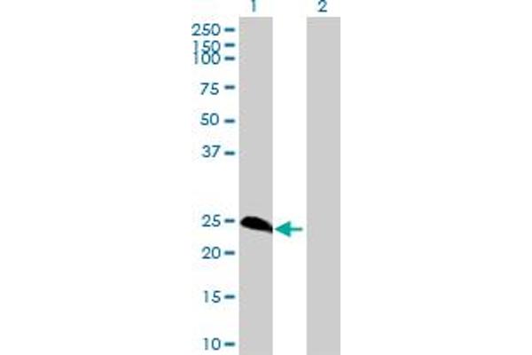 METT5D1 antibody  (AA 1-212)
