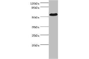 Western blot All lanes: PSEN1 antibody at 2 μg/mL + Hela whole cell lysate Secondary Goat polyclonal to rabbit IgG at 1/10000 dilution Predicted band size: 53, 43, 22, 47, 49 kDa Observed band size: 53 kDa (Presenilin 1 抗体  (AA 1-160))