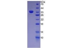 SDS-PAGE of Protein Standard from the Kit (Highly purified E. (Fibronectin CLIA Kit)