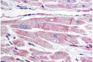Human Heart (formalin-fixed, paraffin-embedded) stained with BIRC7 antibody ABIN298022 at 10 ug/ml followed by biotinylated anti-mouse IgG secondary antibody ABIN481714, alkaline phosphatase-streptavidin and chromogen. (BIRC7 抗体)