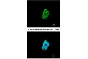 ICC/IF Image Immunofluorescence analysis of methanol-fixed A431, using CMTM6, antibody at 1:200 dilution. (CMTM6 抗体  (C-Term))