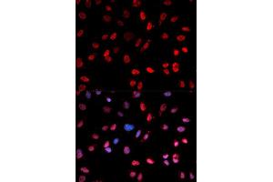 Immunofluorescence analysis of MCF-7 cells using Phospho-ATF2-T71 antibody (ABIN5969881). (ATF2 抗体  (pThr53))