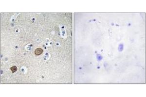 Immunohistochemistry analysis of paraffin-embedded human brain tissue, using Catenin-alpha1 (Ab-641) Antibody. (CTNNA1 抗体  (AA 607-656))