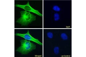 Immunofluoresence staining of fixed HeLa cells with anti-Alpha-tubulin antibody F2C. (Recombinant alpha Tubulin 抗体)