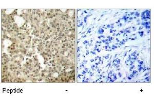 Image no. 1 for anti-Protein Kinase C, delta (PKCd) (AA 643-647) antibody (ABIN197564) (PKC delta 抗体  (AA 643-647))