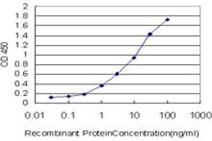 Detection limit for recombinant GST tagged DPYD is approximately 0. (DPYD 抗体  (AA 1-110))