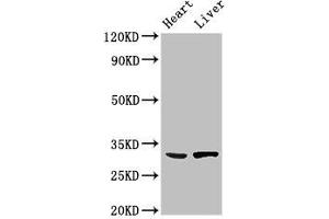 Western Blot Positive WB detected in: Mouse heart tissue, Rat liver tissue All lanes: SDCBP antibody at 3 μg/mL Secondary Goat polyclonal to rabbit IgG at 1/50000 dilution Predicted band size: 33, 32 kDa Observed band size: 33 kDa (SDCBP 抗体  (AA 21-228))