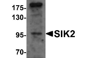 Western blot analysis of SIK2 in SW480 cell lysate with SIK2 antibody at 1 µg/mL. (SIK2 抗体  (Middle Region))