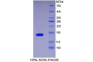 SDS-PAGE analysis of Human Interleukin 1 delta Protein. (FIL1d 蛋白)