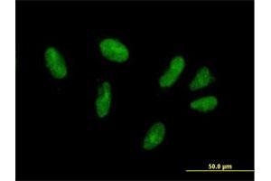 Immunofluorescence of purified MaxPab antibody to ZFP28 on HepG2 cell. (ZFP28 抗体  (AA 1-349))